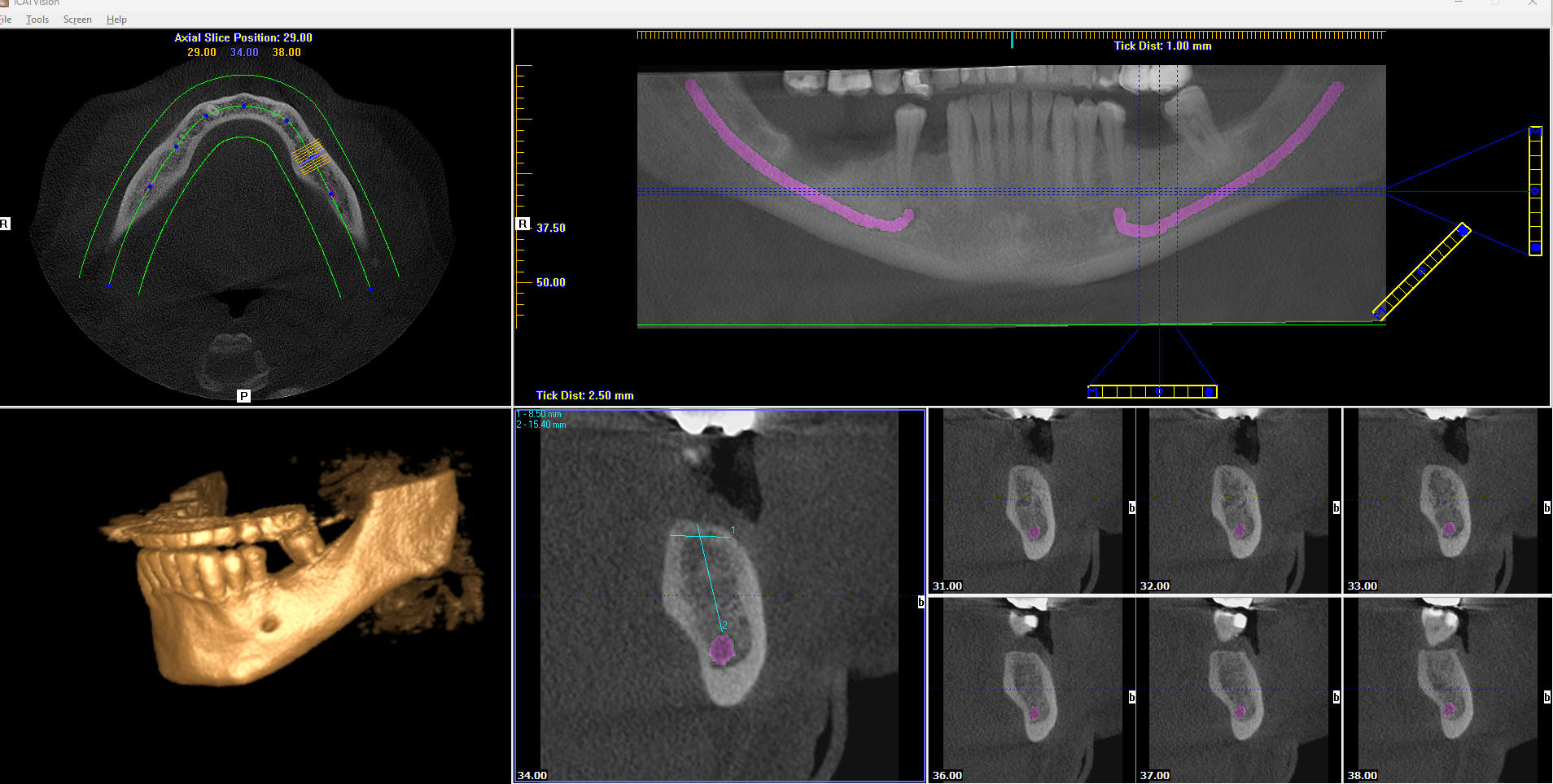 CBCT Scan Photo