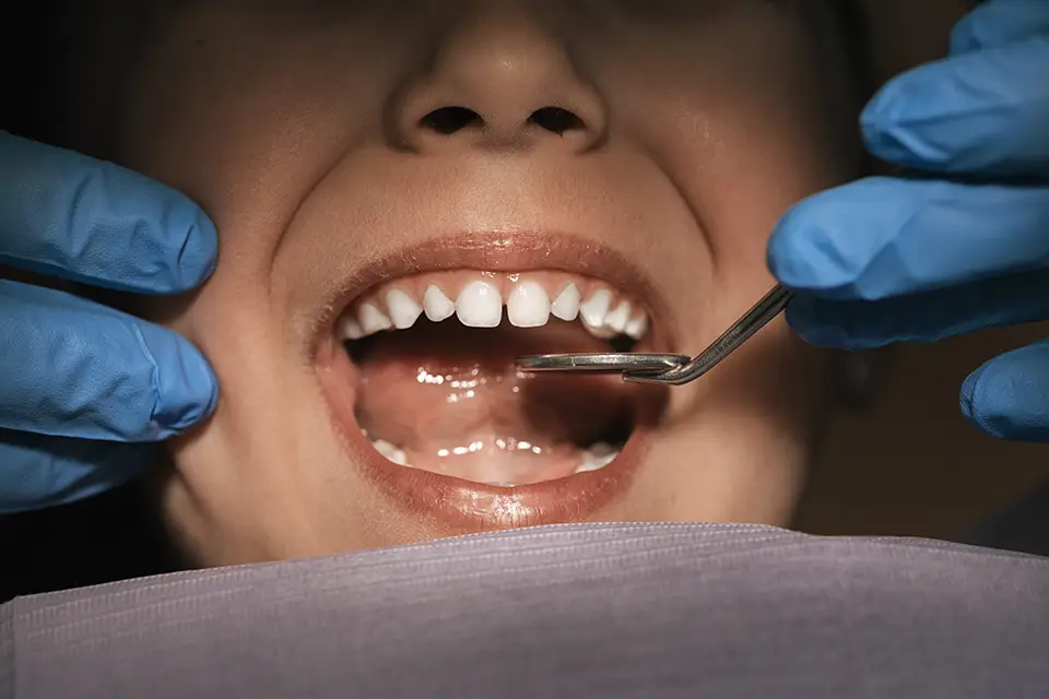 Dental Filling Types: Your Guide to Restoring Teeth
