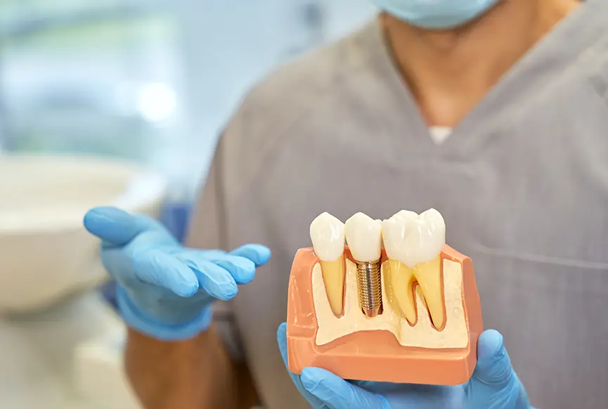 Dental Implant Problems Treatment