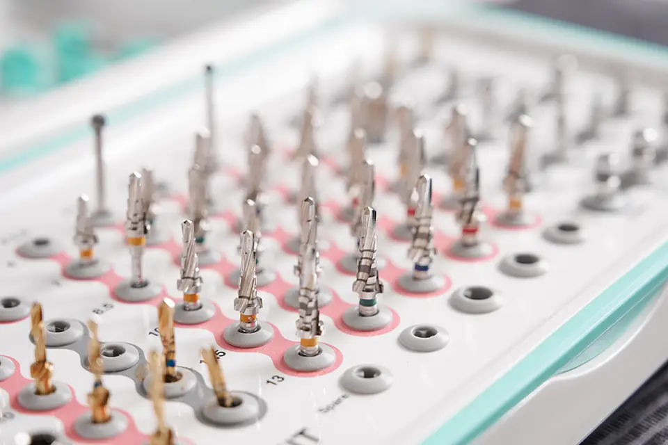 Screwless Dental Implants in Sidcup