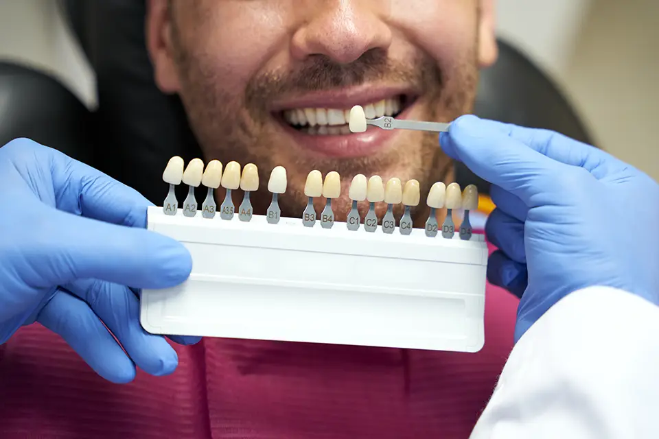 Same-Day Veneers: A Faster Path to a Confident, Natural-Looking Smile