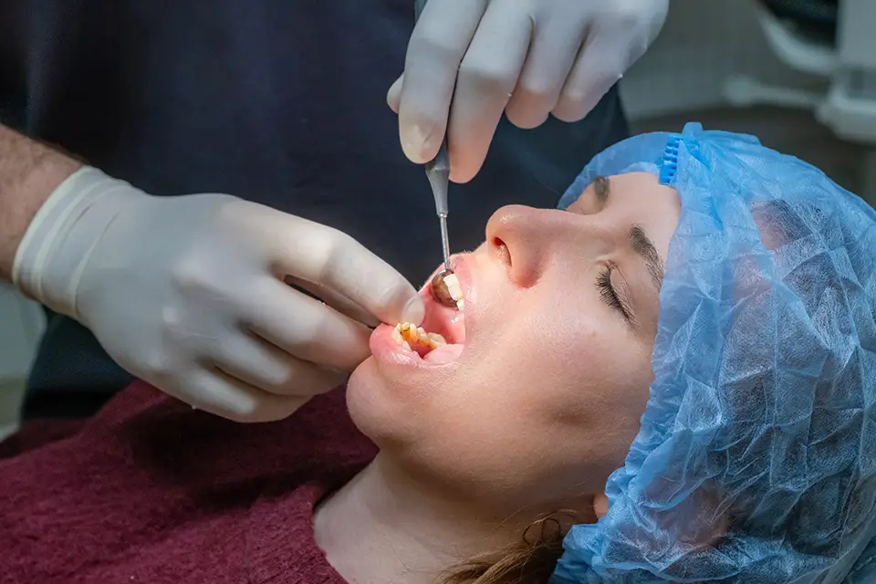 Alveoloplasty in Sidcup: Jawbone Smoothing for Better Dentures and Implant Planning