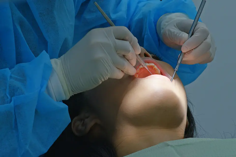 Success Rate: How Successful Is Ridge Augmentation?