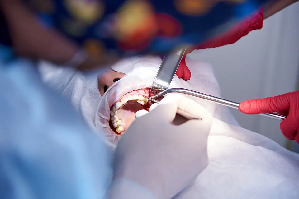 Ridge Augmentation vs Bone Graft: The Key Differences