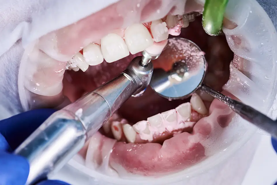 Guided Tissue Regeneration Cost in the UK: What Influences the Price?