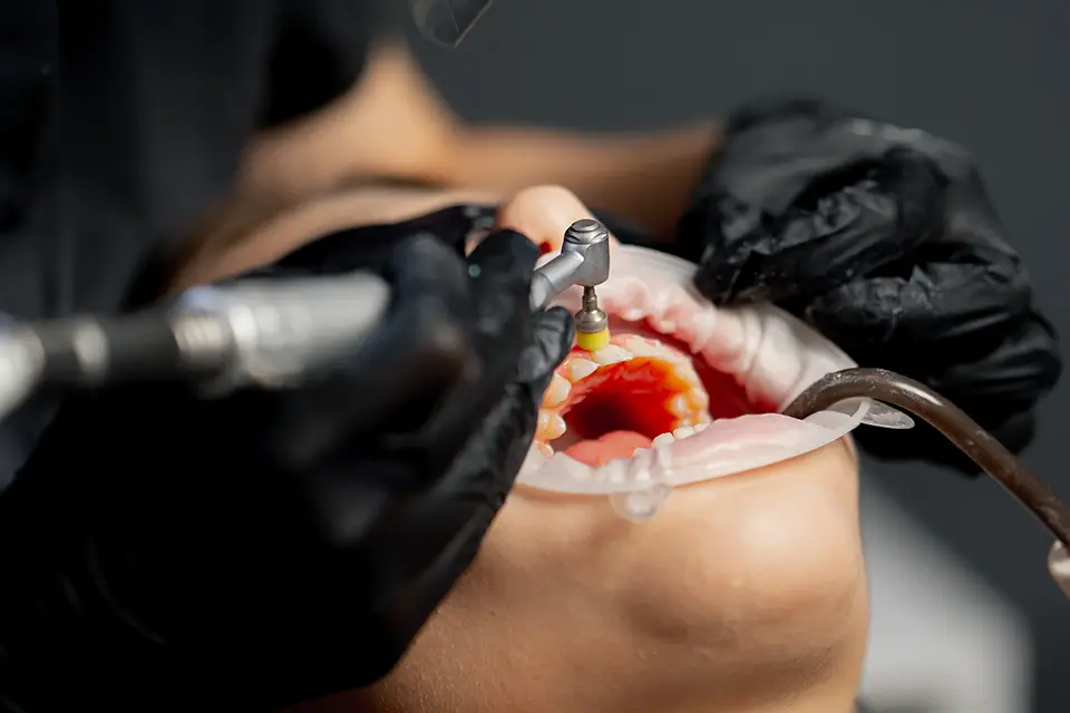 Guided Tissue Regeneration (GTR): Cost, Recovery, Before and After, and Who It's For