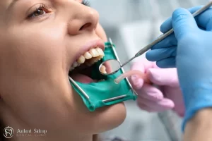 dental bridge procedure patient examination