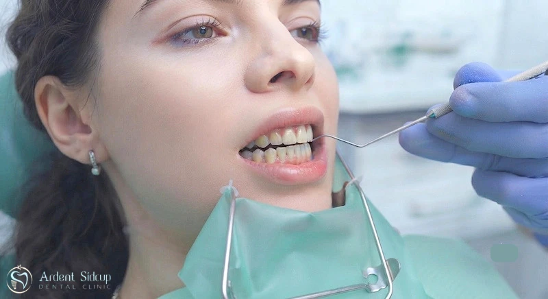 Bridge Work Dental
