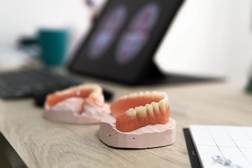 CAD-CAM Digital Dentures-02