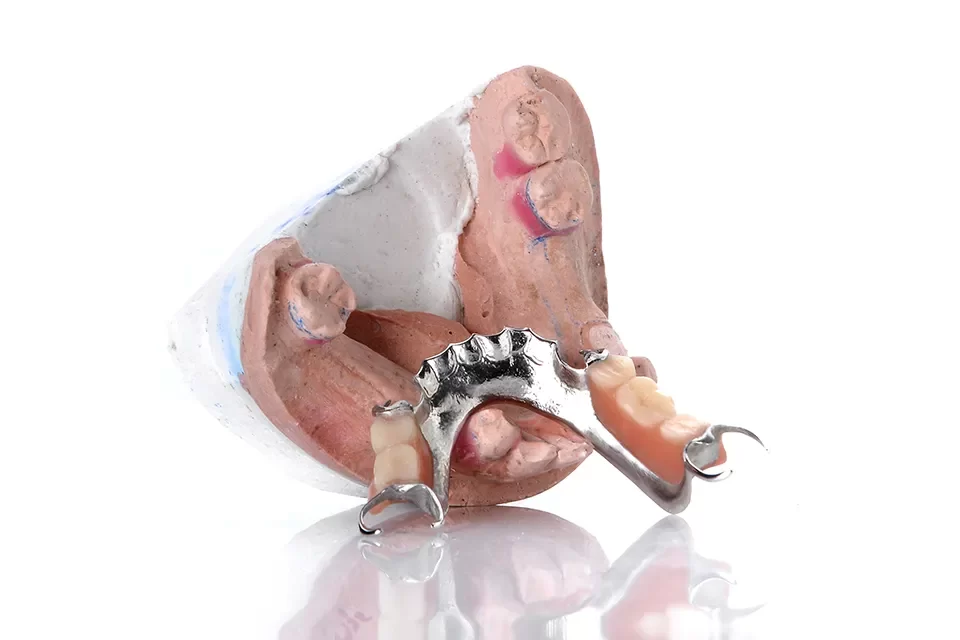 Chrome Cobalt Dentures-02