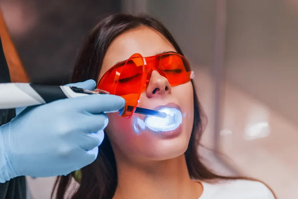 Cosmetic Dentistry: Teeth Whitening