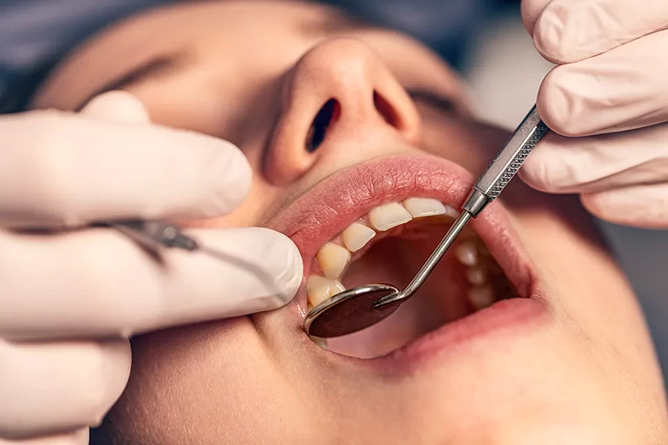 Cosmetic Dentistry: Tooth Coloured Fillings