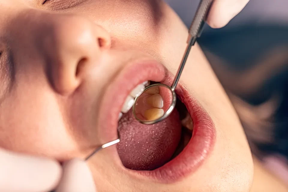Dental Hygiene-04