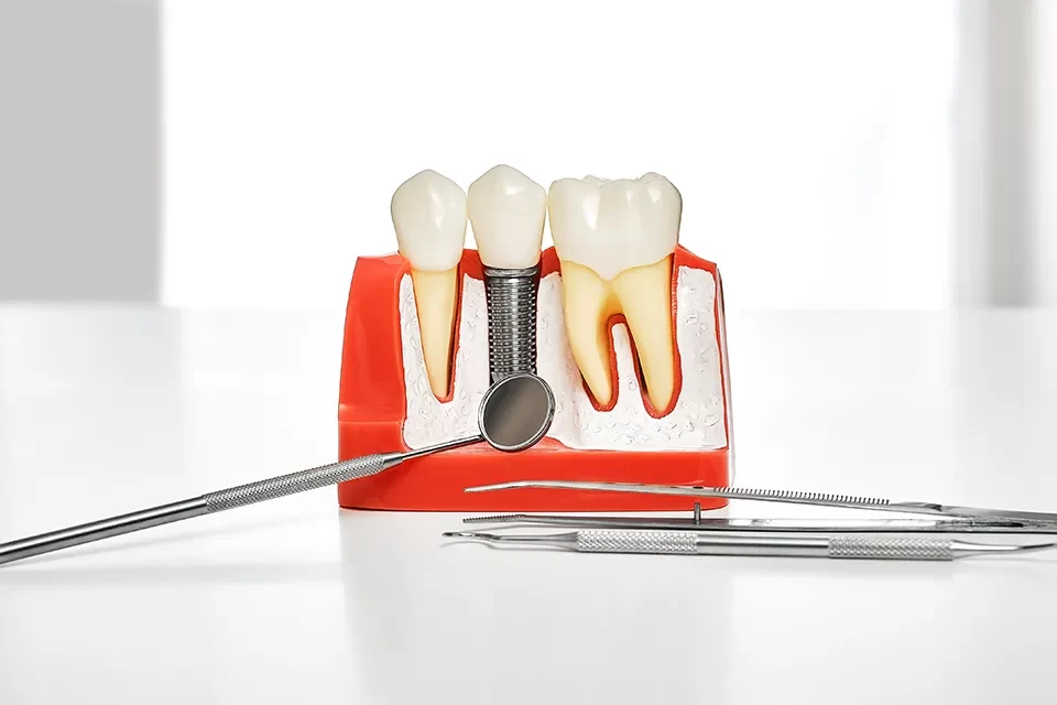 Is Dental Implant Placement Painful?