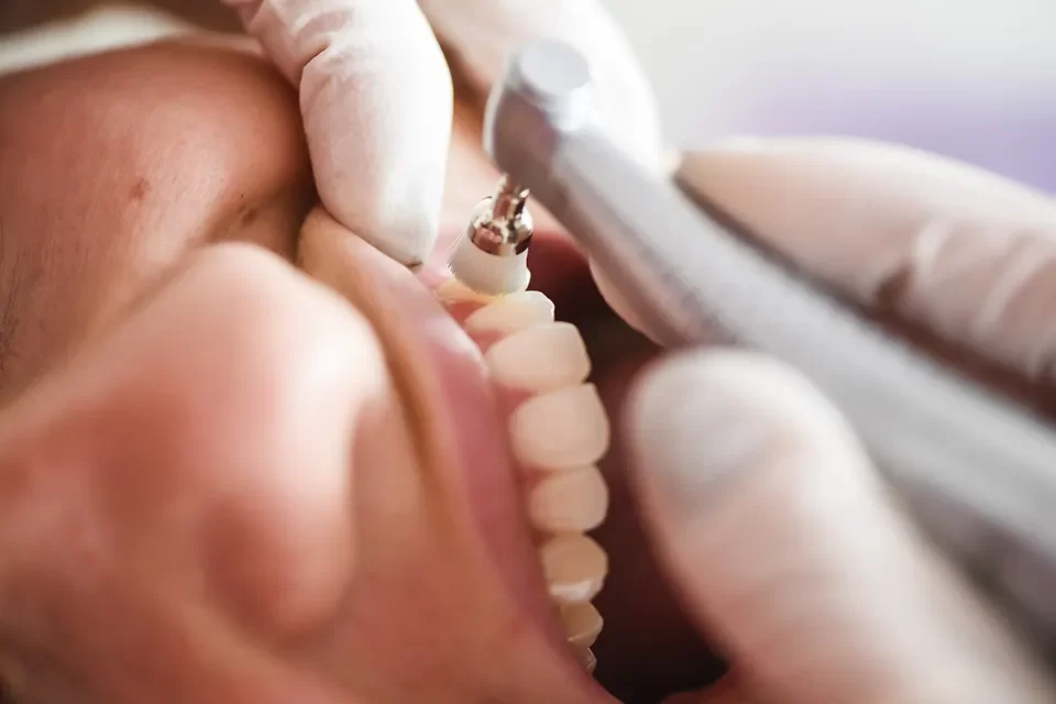 Dental Hygiene