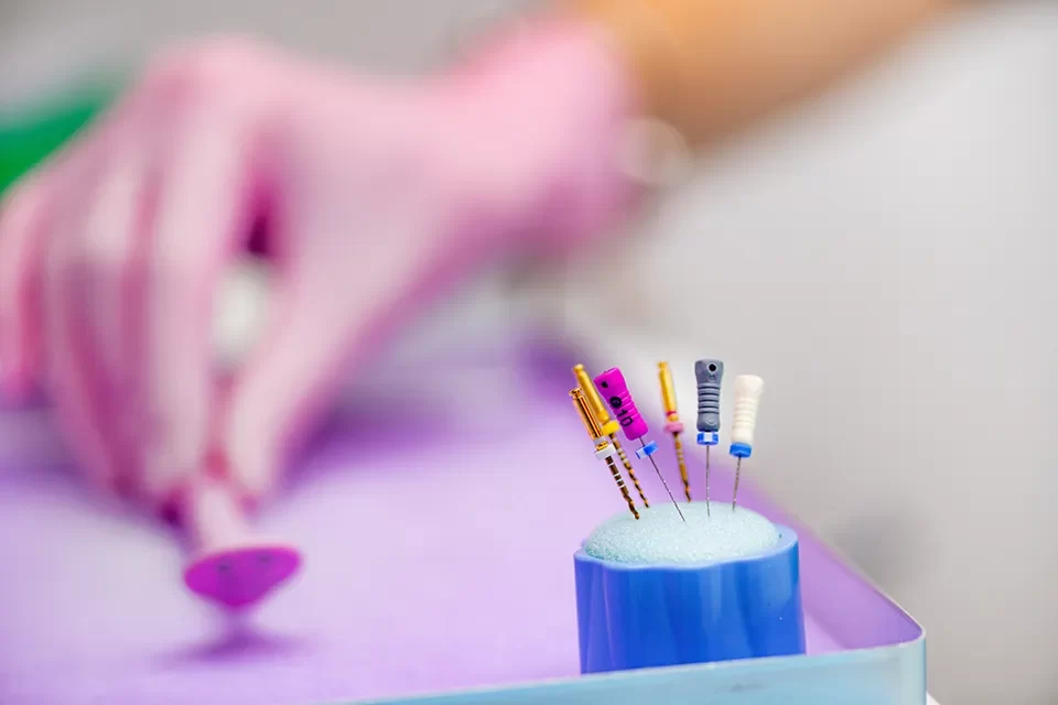 Root Canal Treatment