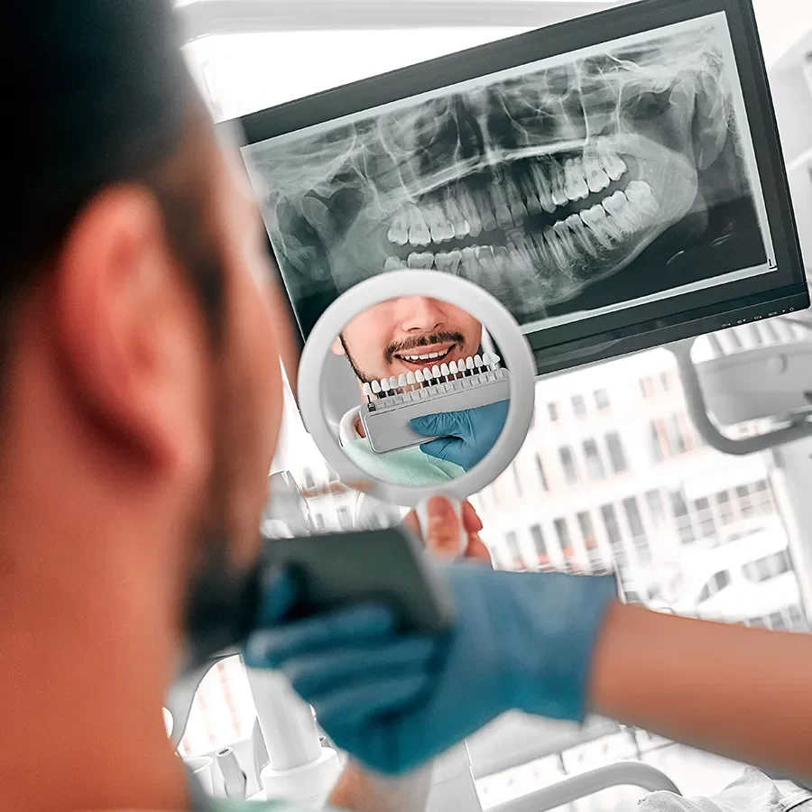 Benefits of Veneers for Teeth
