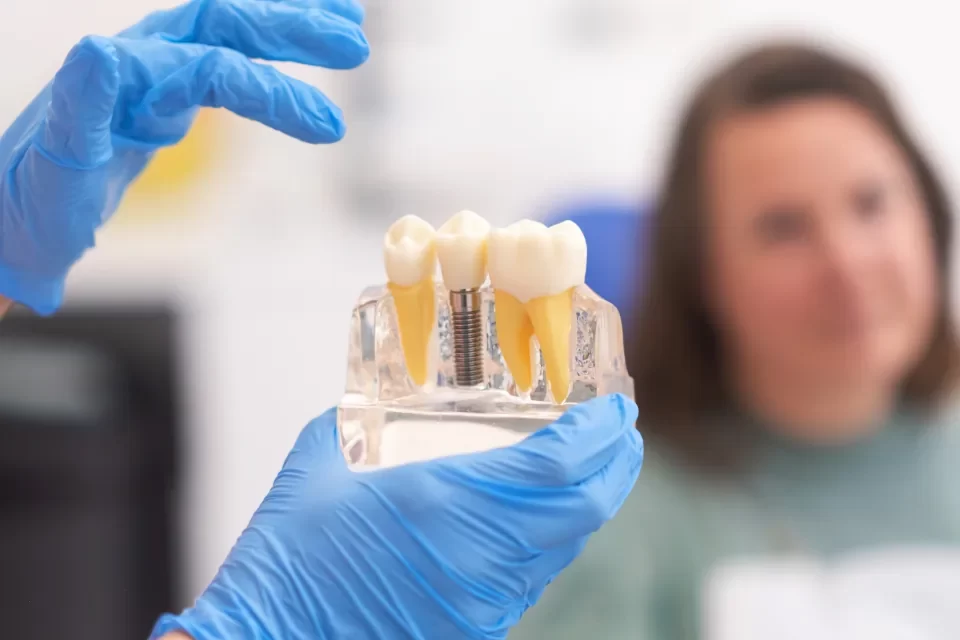 Zygomatic Implants Pros and Cons