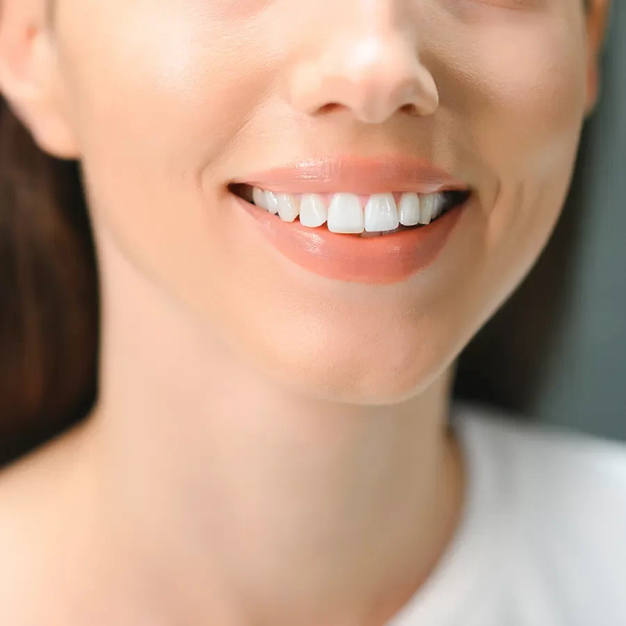 Flexible Valplast Denture-03