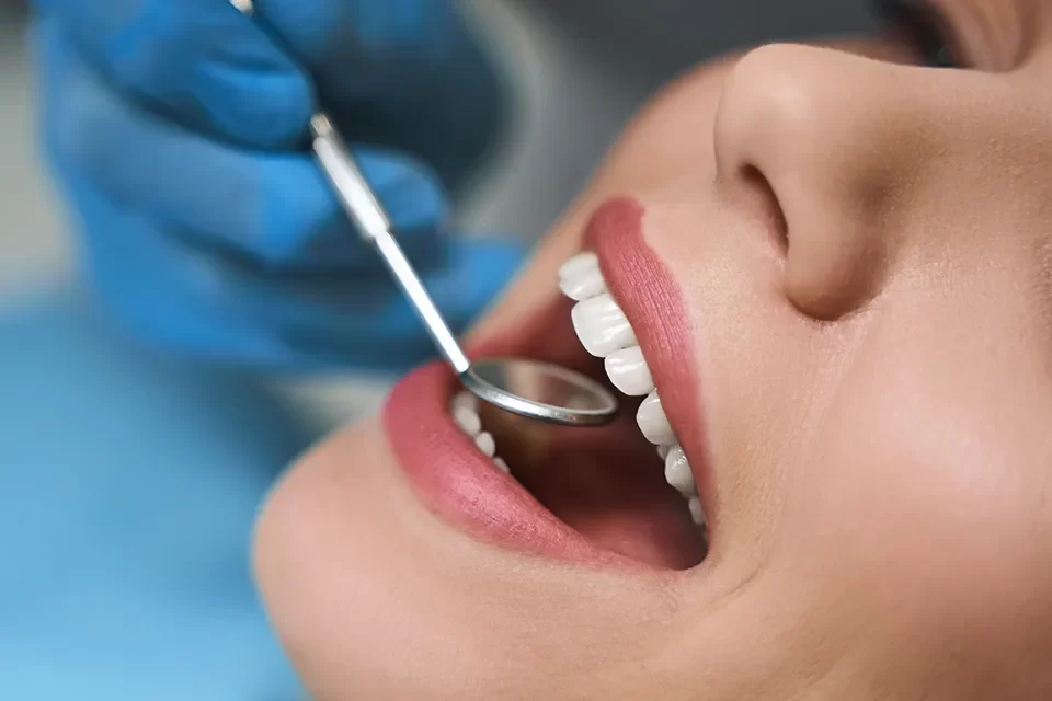 Flexible Valplast Denture-04
