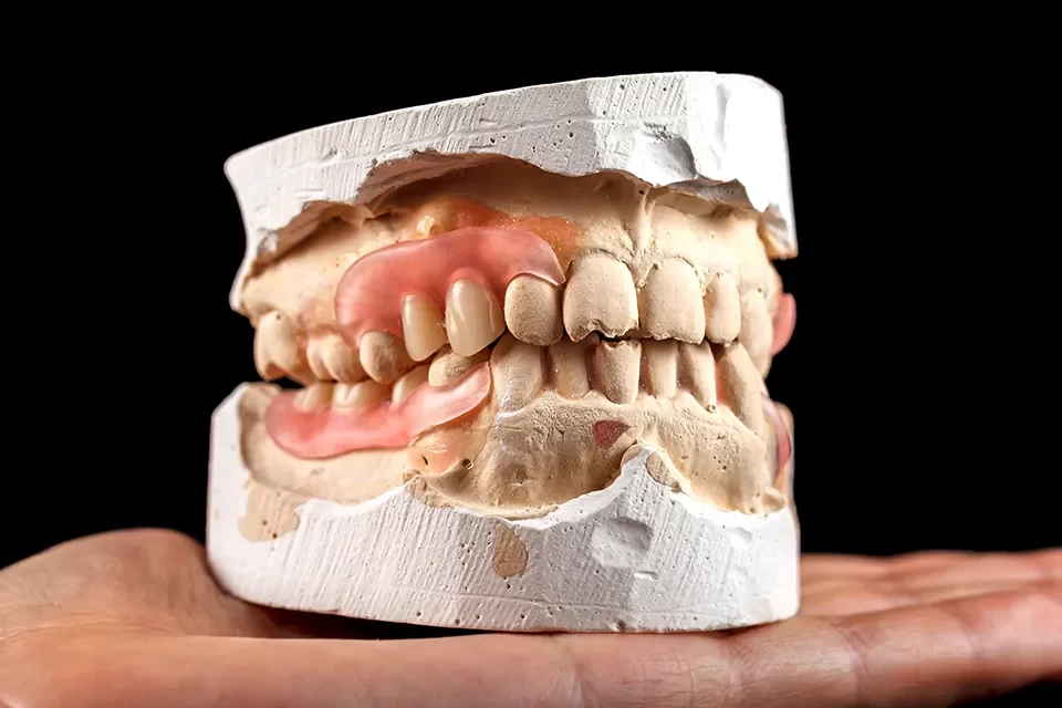 Immediate Dentures-02