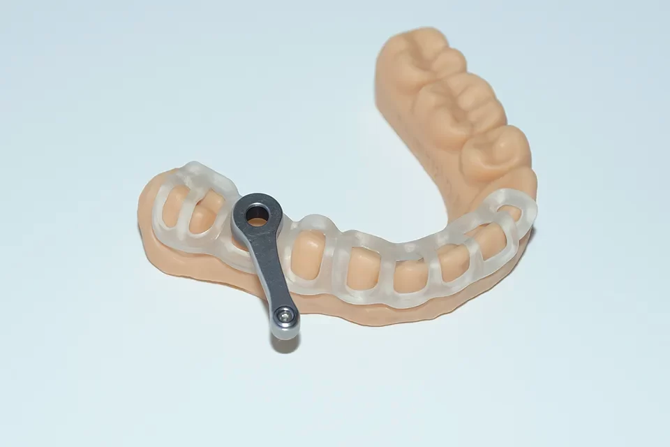 What are Precision Dental Implants?