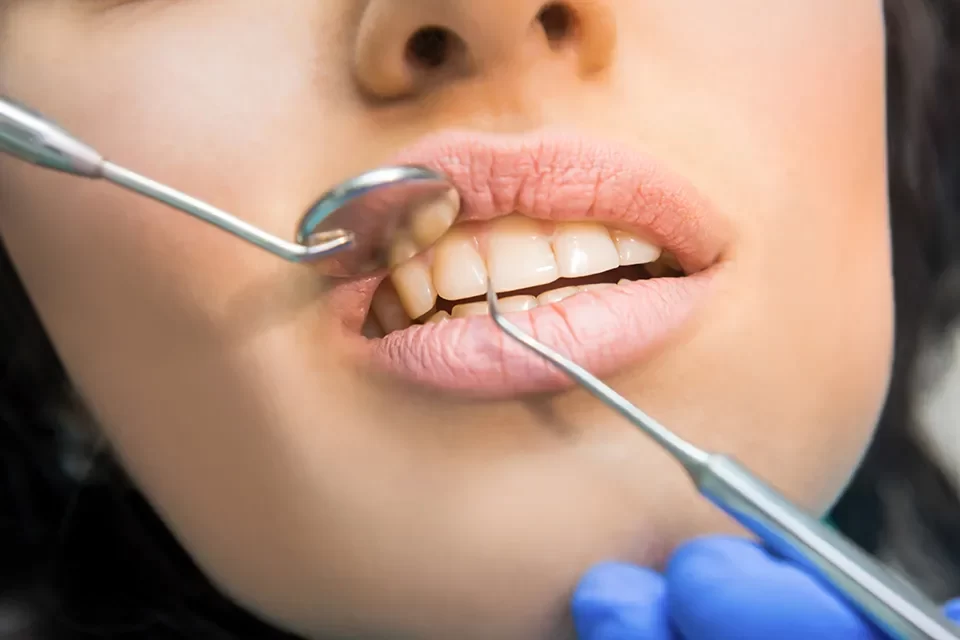 The Multiple Tooth Implants Procedure