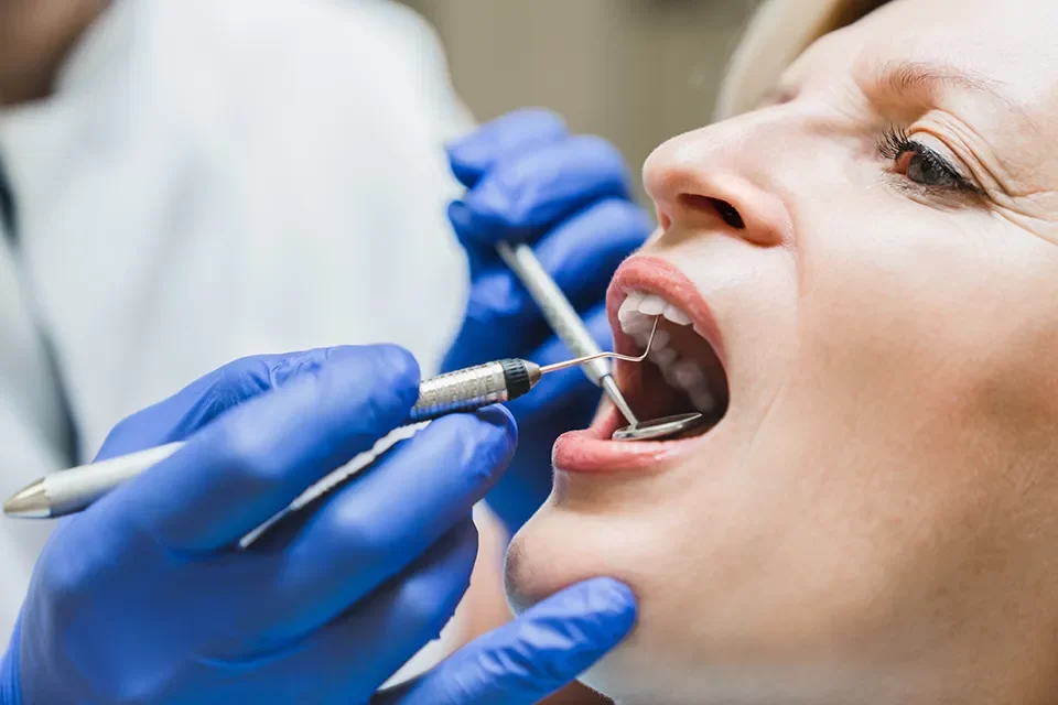 Root Canal Treatment-04