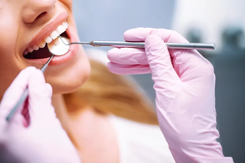 The Tooth Coloured Fillings Procedure