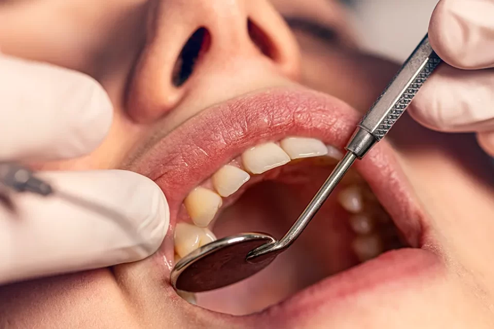 Tooth Replacement 1