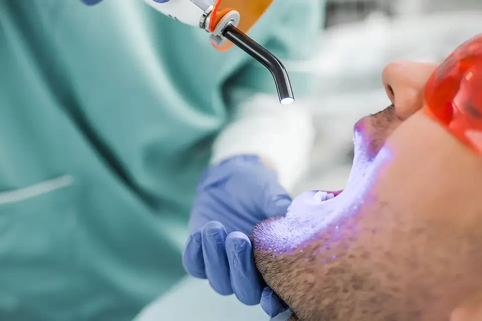Laser Teeth Whitening Pros and Cons