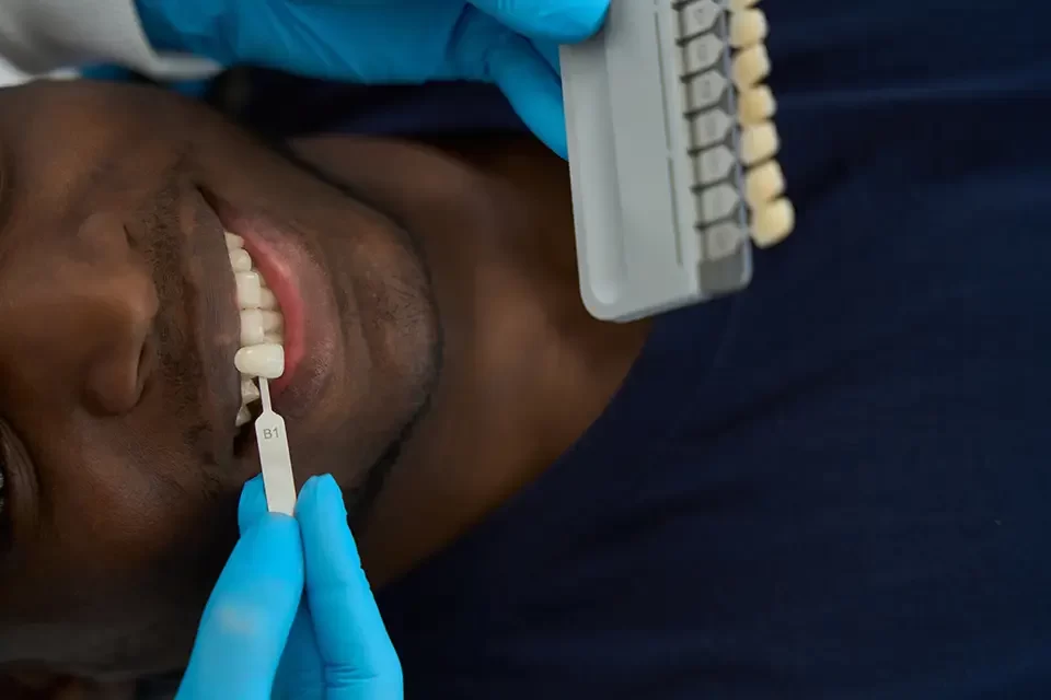 What Are Zirconia Veneers?