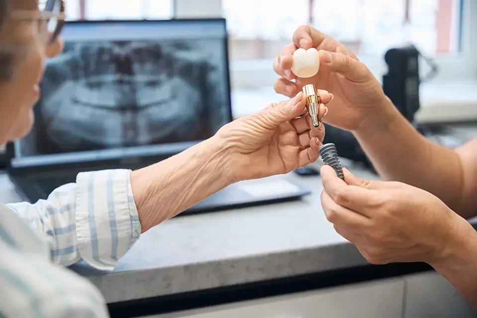 Molar Tooth Implant Near Me