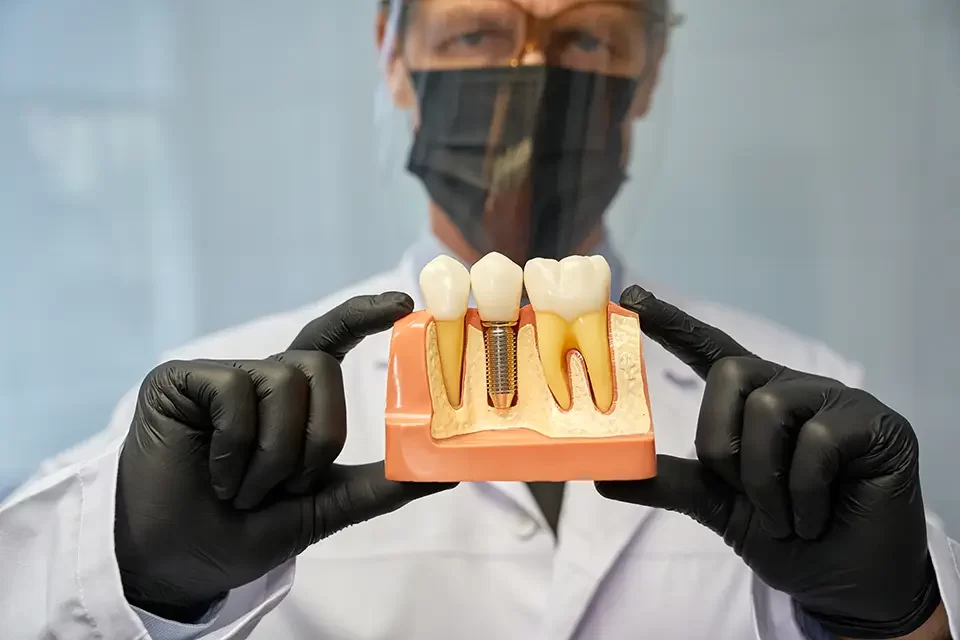 Materials used in endosteal implants