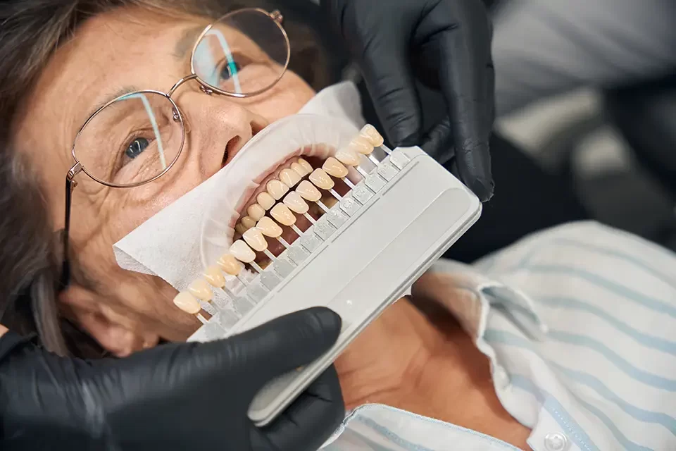 Emax Veneers Cost