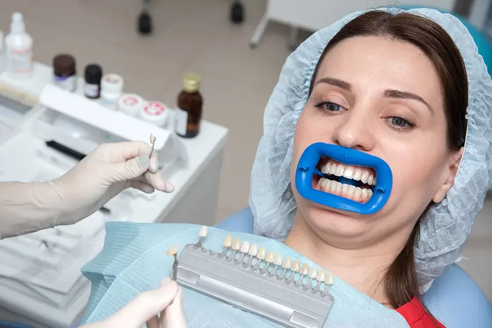 Snap-on Veneers Cost (What Drives the Number)