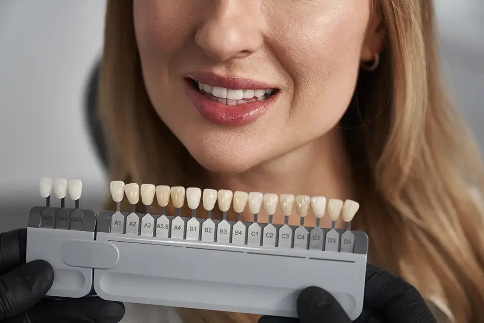 Same-Day Veneers Cost